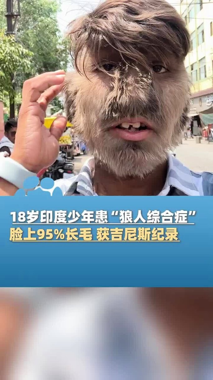 美女扒开逼操的相关介绍